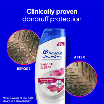 Smooth & Silky Anti-Dandruff Shampoo